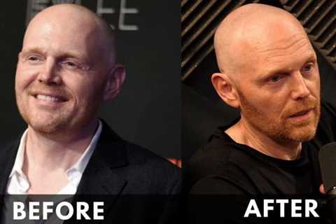 Bill Burr Weight Loss [2023], Before and After Journey